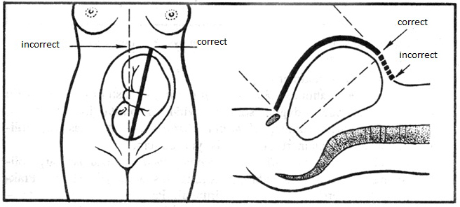 symfyse_fundus_2.png